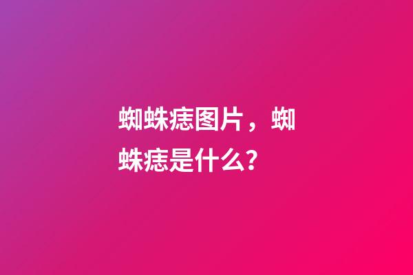 蜘蛛痣图片，蜘蛛痣是什么？